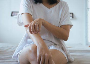 Cannabis-gegen-Schuppenflechte