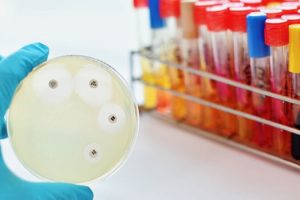 Meningite da Cannabis Outdoor? Purtroppo è Possibile!