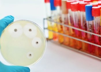 Hirnhautentzündung durch Outdoor-Cannabis? Leider nicht unmöglich!