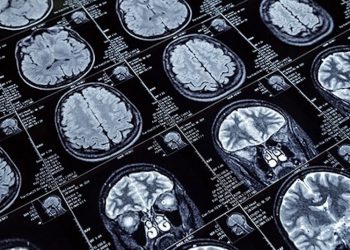 Cannabinoide und das kindliche Gehirn