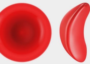 Cannabis bei Sichelzellenanämie