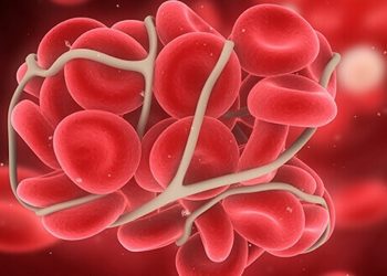 CBD gegen Durchblutungsstörungen