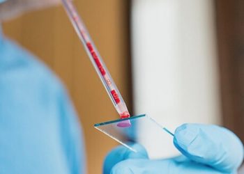 Wie gefährlich ist Cannabis bei Typ-1-Diabetes?