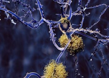 Neuroprotektion – Cannabinoide schützen das Nervensystem