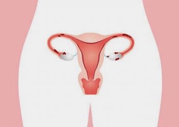 Die Behandlung von Endometriose mit CBD-Öl und medizinischem Cannabis