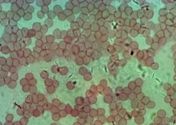 Neues Cannabismedikament gegen Leukämie