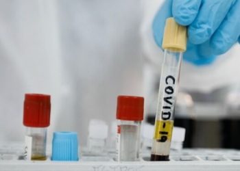 Cannabis vs. Corona: Die Thesen neuer Studien