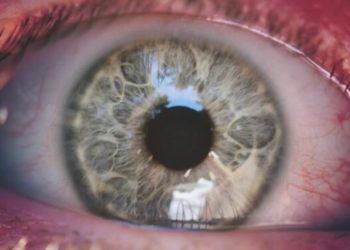 Cannabis helps – Morbus Wilson