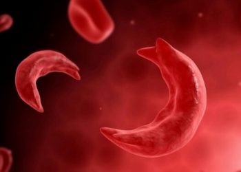 Studie: Cannabis zeigt Potenzial bei der Behandlung der Sichelzellkrankheit