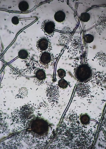 Australische Studie bestätigt die antimykotische Wirkung von CBD und CBDV