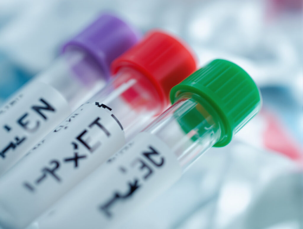 Versiegelte Laborproben symbolisieren medizinische Tests und Datenschutz