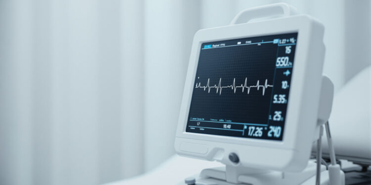 EKG-Monitor mit Herzrhythmus-Kurve in klinischer Umgebung